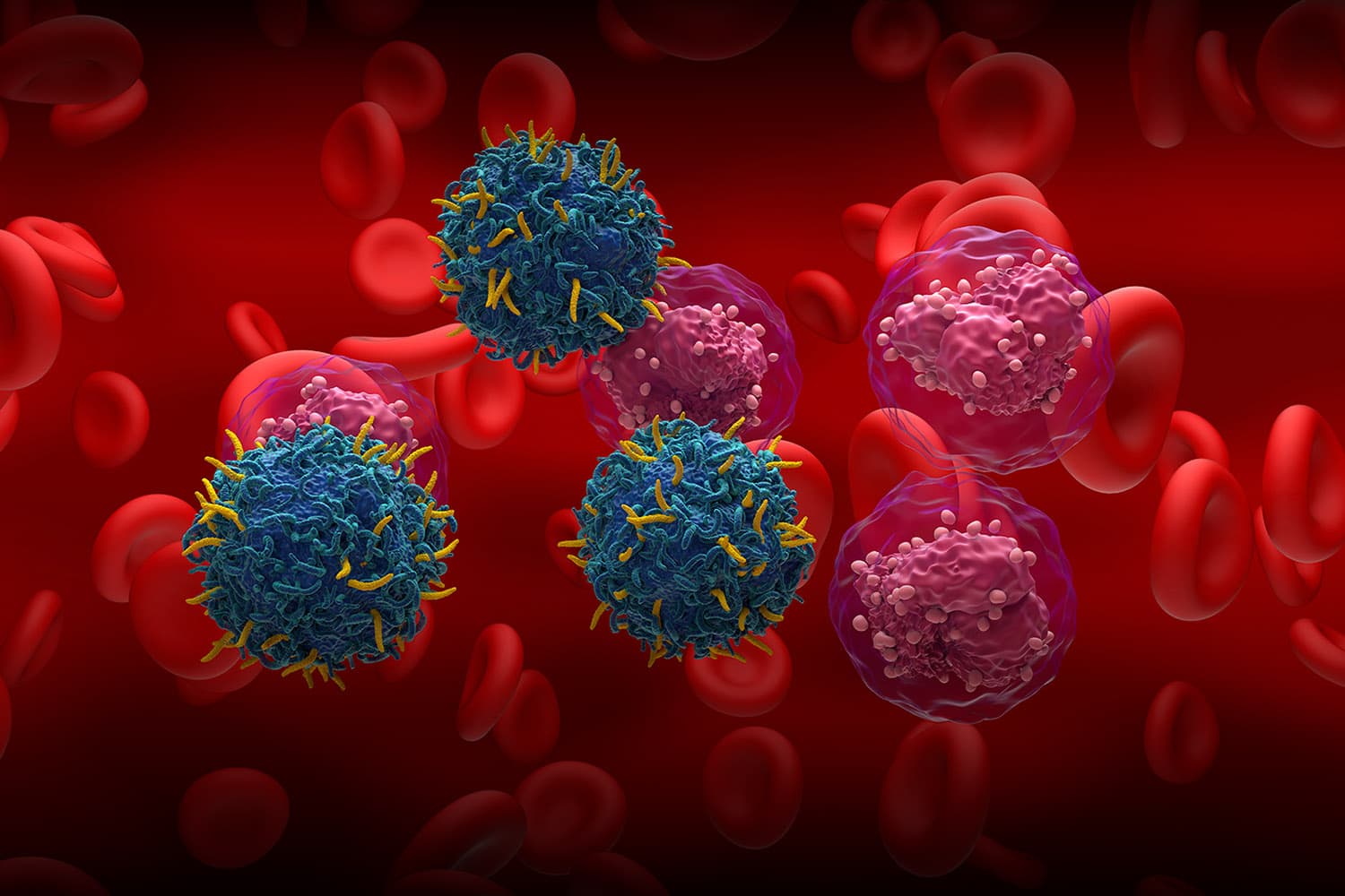 ‘ศิริราช’ ทำสำเร็จ พัฒนา ‘CAR T-Cell’ นวัตกรรมรักษามะเร็งเลือด ความหวังใหม่ผู้ป่วยโรคมะเร็ง